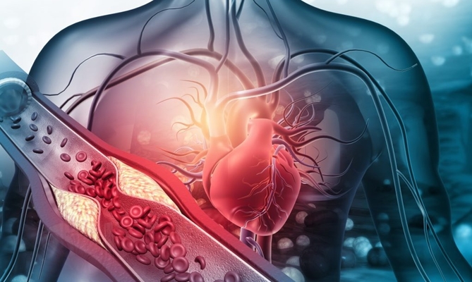 Cardiovascular disease